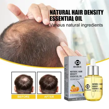 30 мл натурального эфирного масла имбиря для густоты волос, предотвращающего потерю жидкости, Восстанавливающего Сыворотку для быстрого роста Nutirents Beauty Health Care
